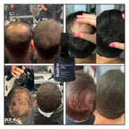 Hair Density Filler